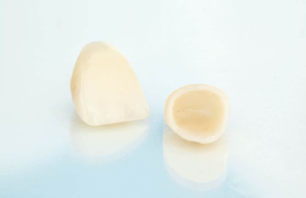 Porcelain Crowns - Boeriu Implant Dentistry - Kitchener Dentist